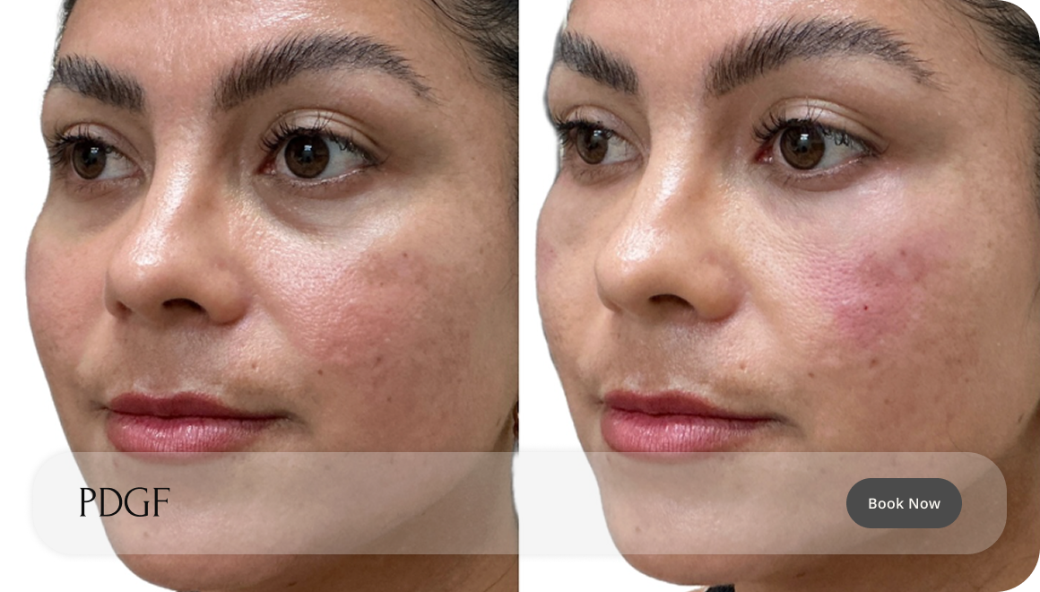 B&A