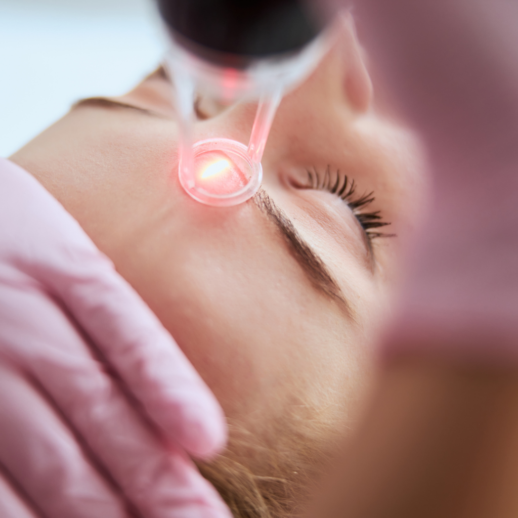 CO2 laser device being used for advanced skin correction and resurfacing at Naturalness Med Spa