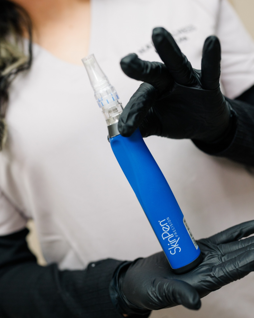 RF microneedling and SkinPen treatments in Murrieta, CA